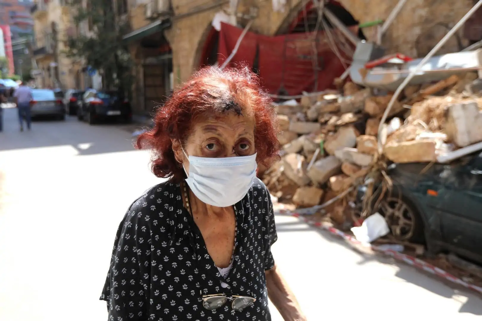 A woman, who says she was injured following Tuesday's blast, walks past damage along a street in Beirut, Lebanon, August 10, 2020. REUTERS/Mohamed Azakir - RC21BI9WNNU8